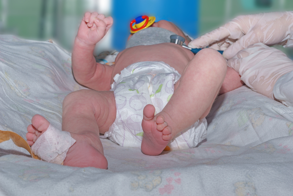 Causes Of Birth Injuries